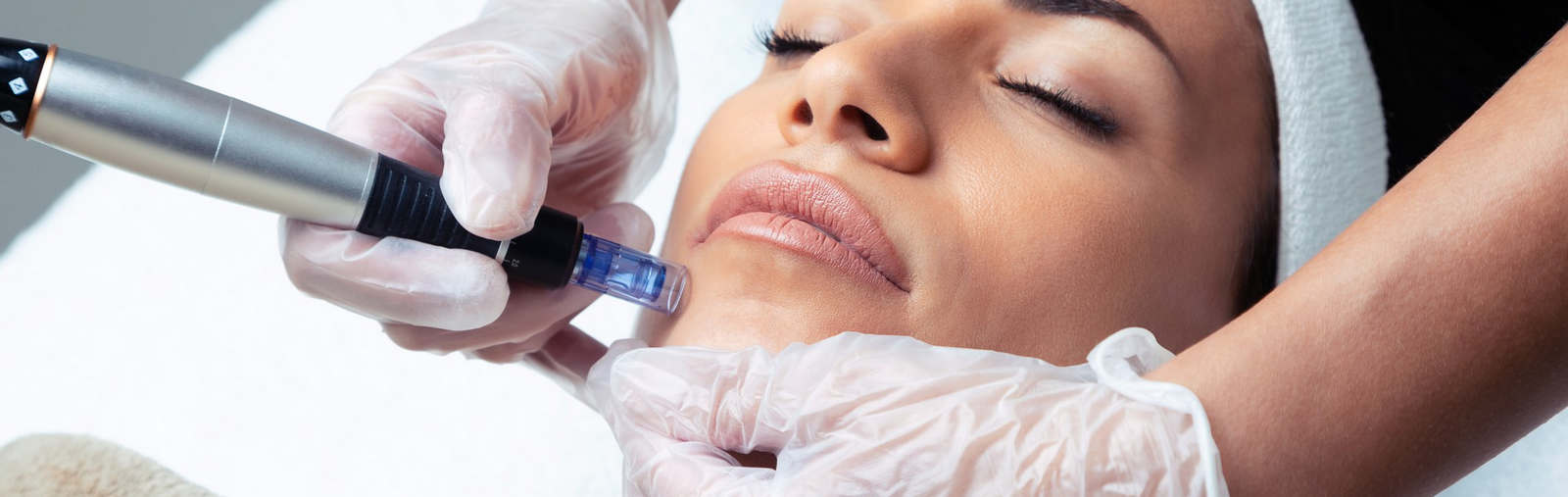 Dermapen bei Dr. Manuel Morancho