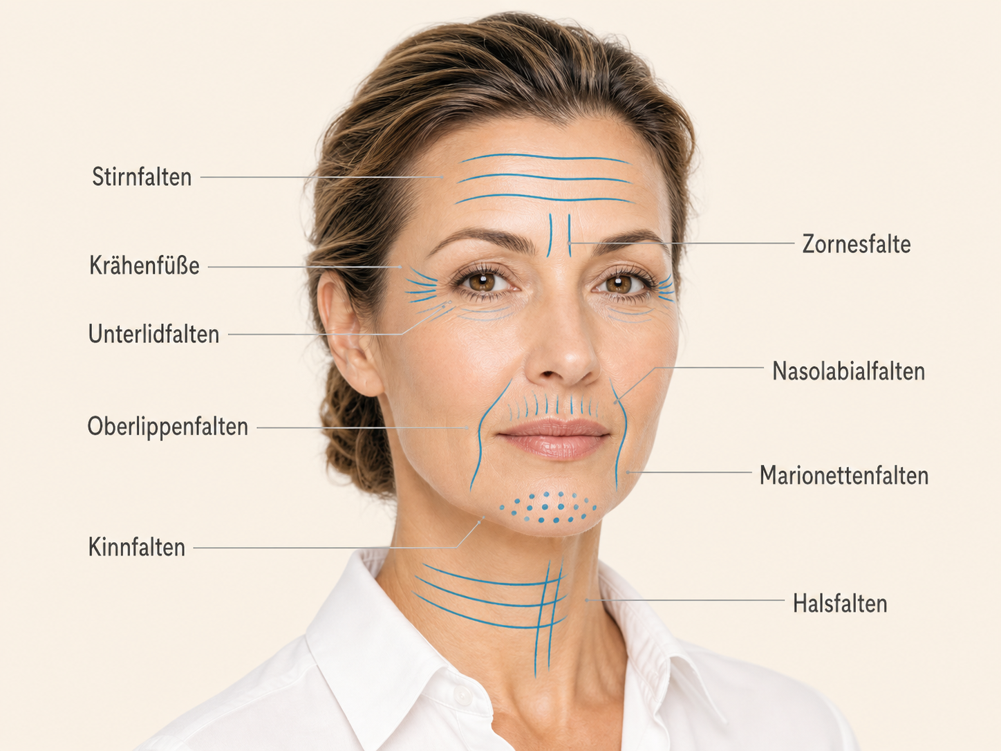 Medizinische Übersicht typischer Faltenverläufe im Gesicht und am Hals